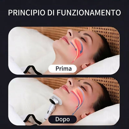 Dispositivo Anticicchera Notturno Indossabile con Sensori Automatici | Anselora